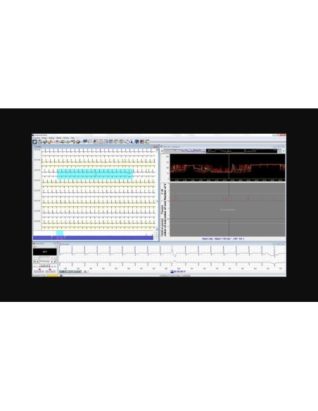 Interface logiciel HolterSoft Ultima Novacor — analyse Holter ECG